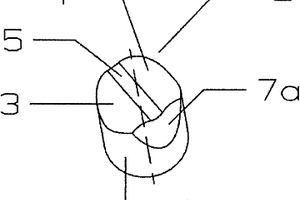 用于孕鑲鉆頭的孕鑲齒