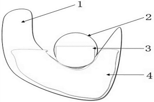 冶金鑄造吊行車耳軸對位結構