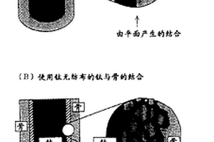 鈦纖維醫療材料