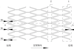 非對稱式的血管支架