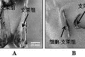 用于骨缺損治療和修復的細胞-支架復合材料制備方法及其應用