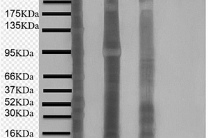 具有抗蛋白吸附性能和光动力效应的复合材料及制备方法