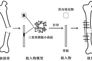 復合材料和結構功能的金屬骨植入物的制造方法