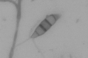 重金屬抗性新擬盤多毛孢屬微生物及其應用