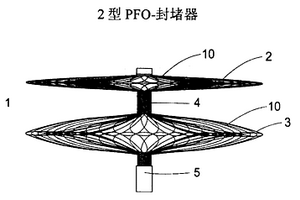 醫療自膨脹封堵器