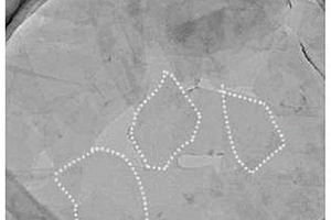 應用于鋰離子電池負極的Ti<Sub>3</Sub>C<Sub>2</Sub>-Mxene材料制備方法