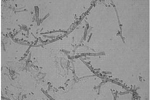 枝孢菌株及其微生物菌劑以及制備方法和應用