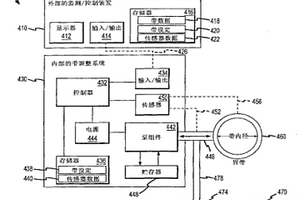 自調節胃帶