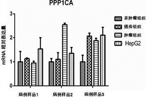 PPP1CA作為肝癌診斷和檢測預后的標志物及其應用