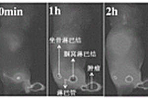 基于腫瘤前哨淋巴結探測的熒光造影劑及其制備方法