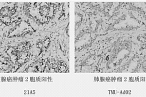 抗Napsin A蛋白的單克隆抗體及其細胞株、制備方法和應用