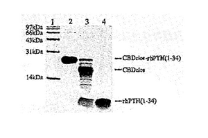 重組人甲狀旁腺激素在大腸桿菌中的構建、表達與純化方法
