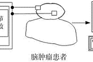 基于磁共振電阻抗成像的腦部腫瘤檢測系統