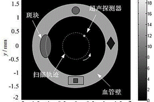 血管內光聲圖像的時間反演重建方法